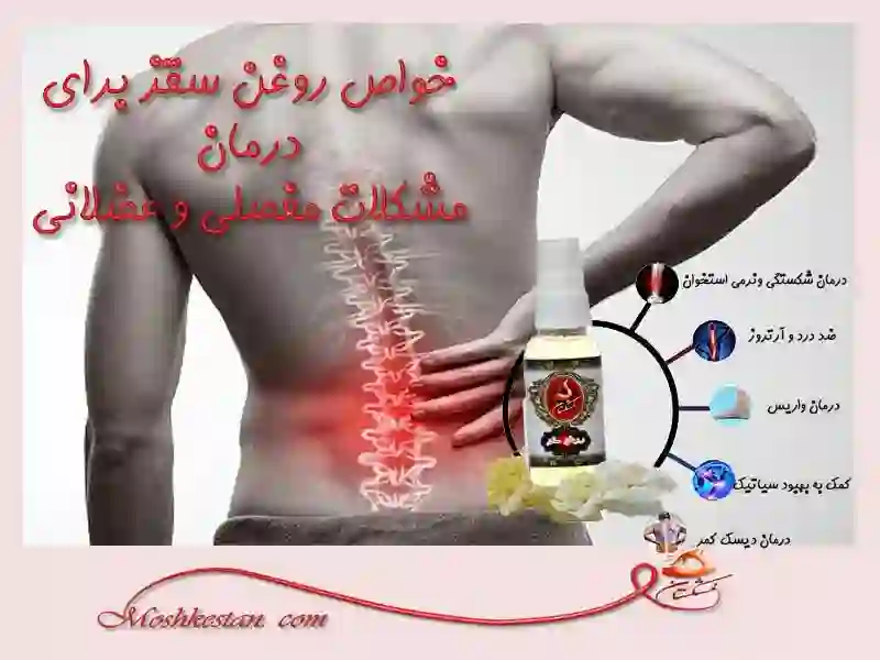 خواص روغن سقز برای دیسک کمر و روماتیسم و سیاتیک