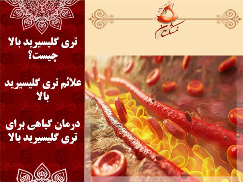 تری گلیسیرید بالا